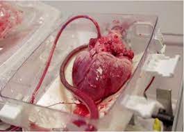انجام دومین پیوند قلب با انتقال هوایی در سال جاری