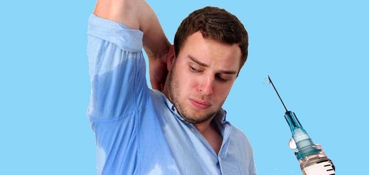 از بوتاکس زیربغل چه میدانید؟